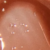13 Tease